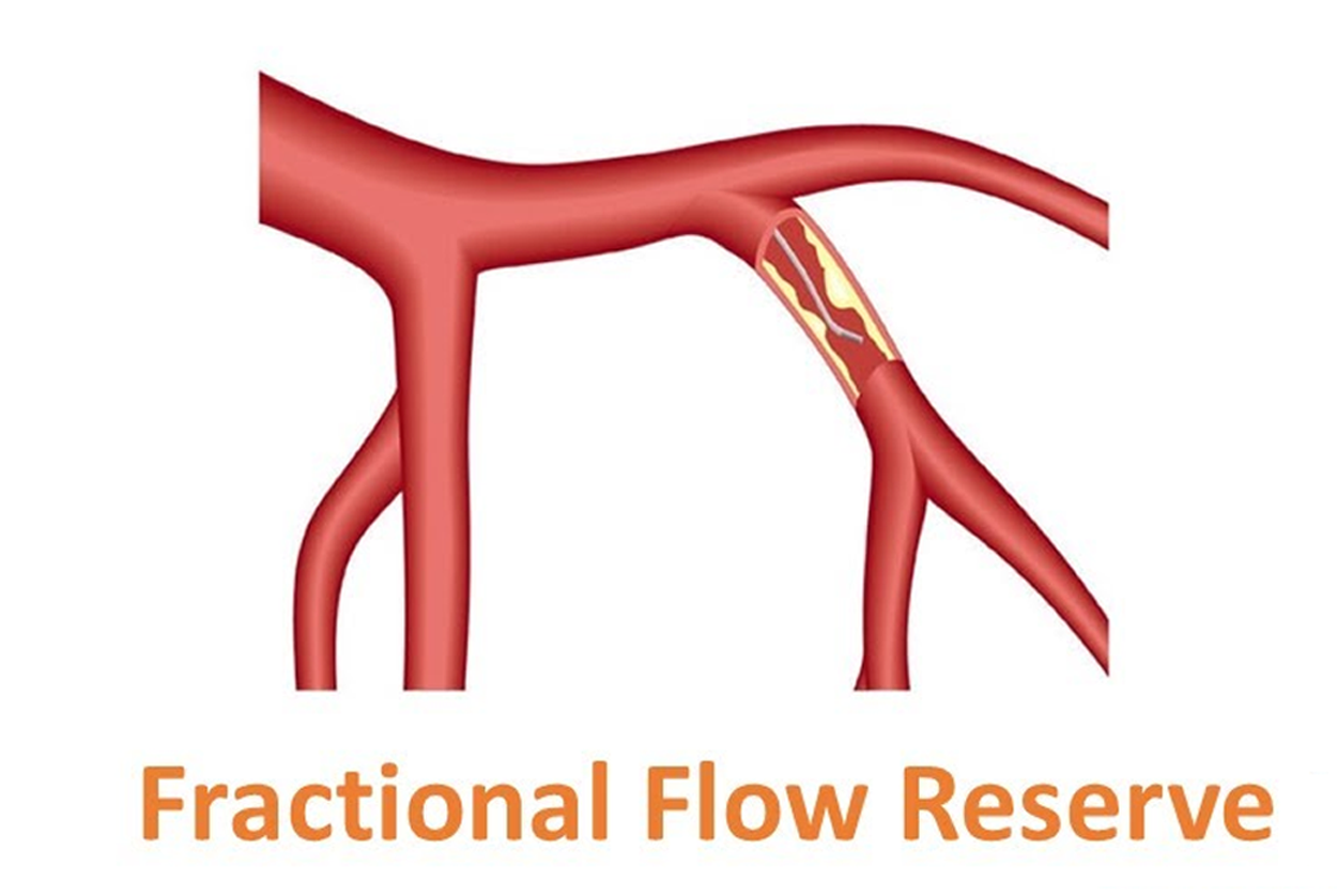 Imaging Guided Interventions