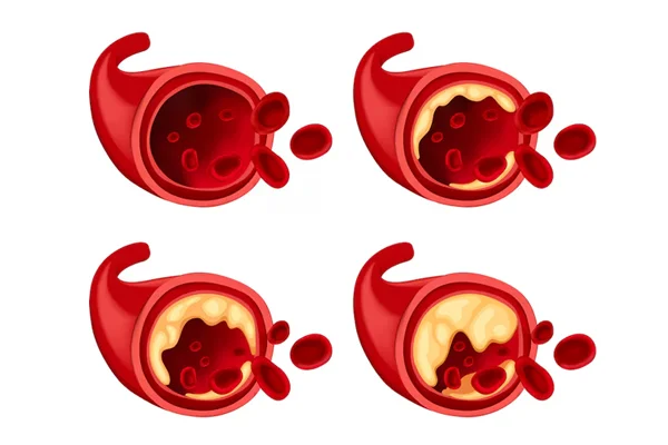 Imaging Guided Interventions