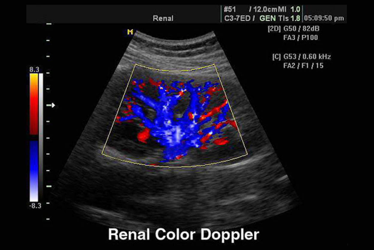 Peripheral Doppler - Renal / Carotid / Arterial / Venous