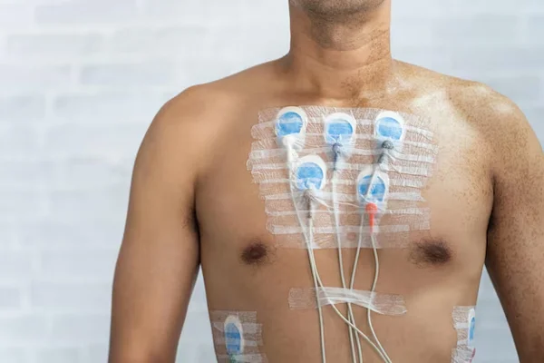 Holter Monitoring