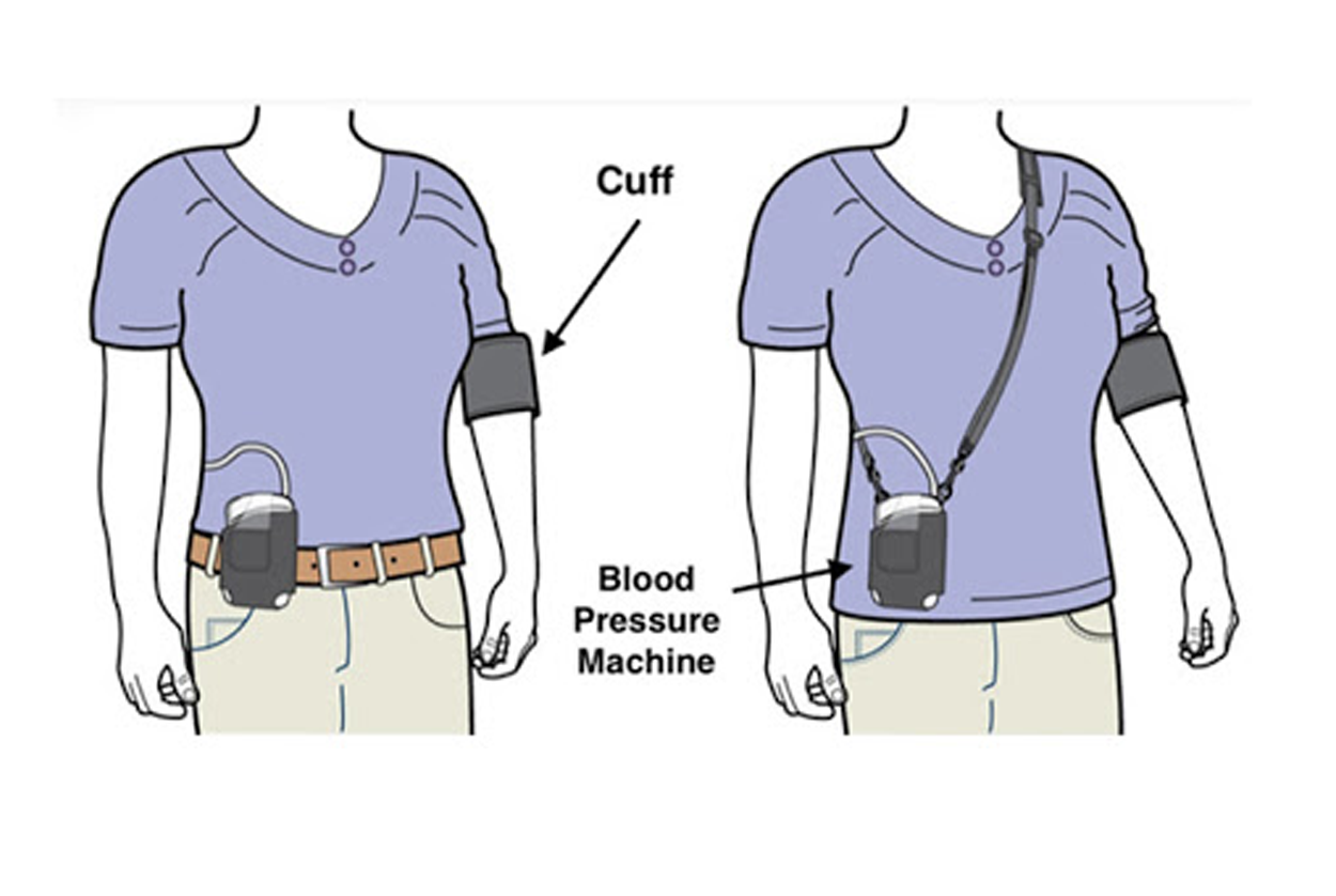 Ambulatory BP Monitoring