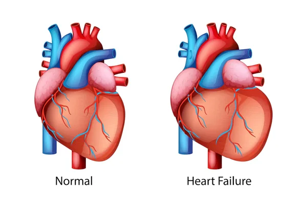 Non Invasive Diagnostics