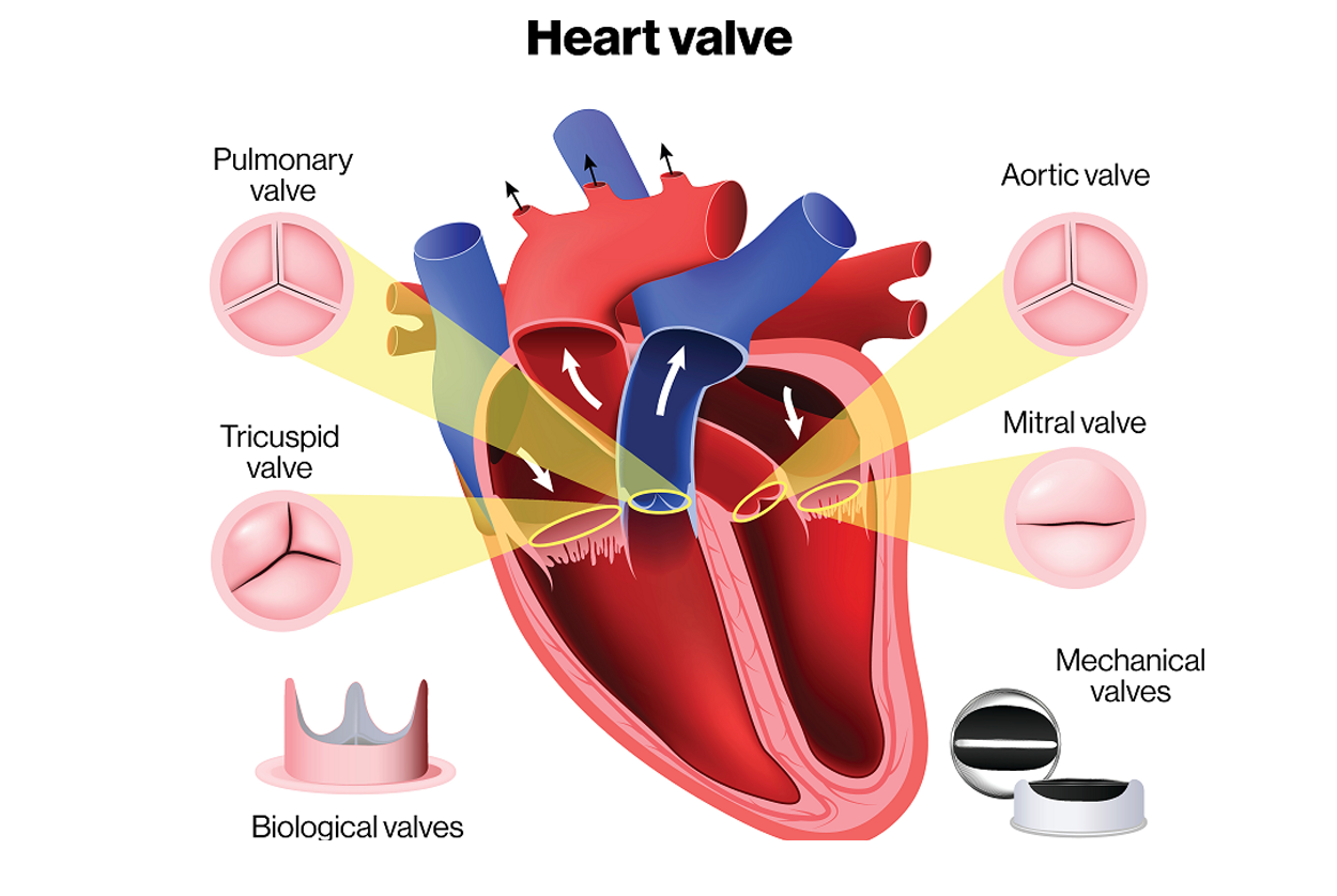 Valvular Heart Disease